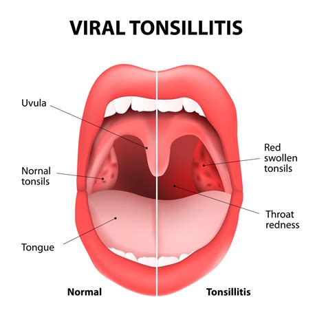 Common Seasonal Allergies and Dental Health | Dr. Nechupadam Dental Clinic