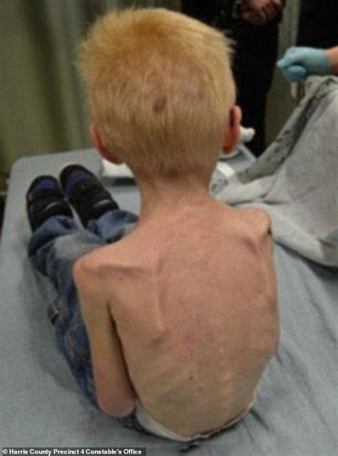 Siblings of five-year-old who was starved revealed how they saved him ...