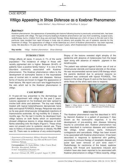 Vitiligo Appearing in Striae Distensae as a Koebner Phenomenon