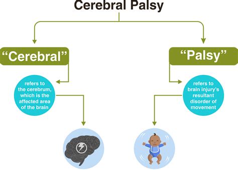 Cerebral Palsy Brain