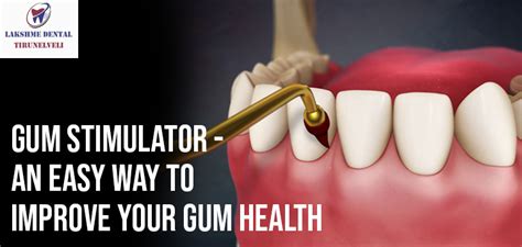 Rubber Tip Gum Simulators | Tips to Improve Your Gum Health