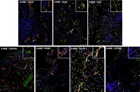 Synovial tissue (ST) angiogenesis, oxidative stress and cellular... | Download Scientific Diagram