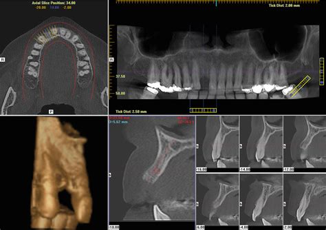 In-Office CT Scans | Walnutport, PA | Professional Dental