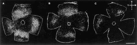 Distribution of cone cells shown in computer-sharpened images at (A) 2 ...