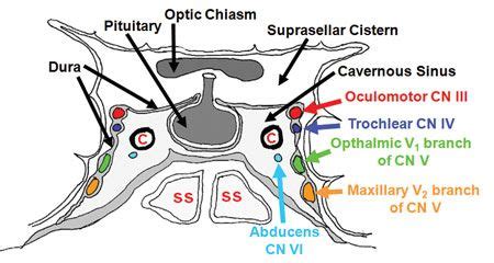 Cavernous Sinus Thrombosis-Signs symptoms-Diagnosis-Treatment and ...