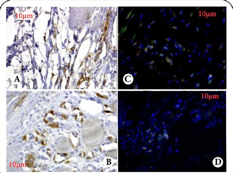 Expression of progenitor cells markers in the zone of connective tissue ...