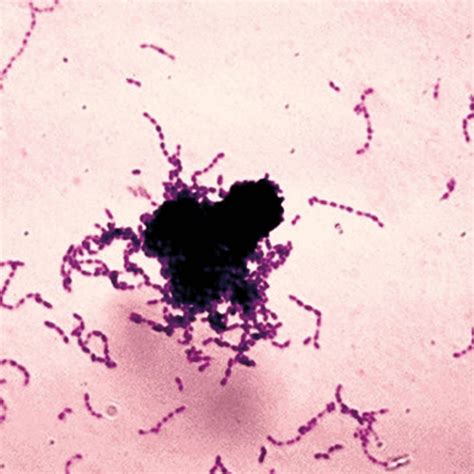 Streptococcus Pneumoniae Under Microscope