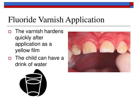 PPT - Fluoride Varnish Application PowerPoint Presentation, free ...