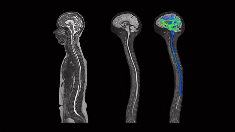 Diffusion MRI Past and Future: An Overview