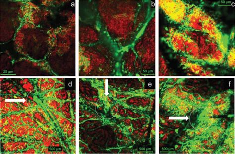 Confocal Laser Scanning Microscopy as a Tool for the Investigation of ...