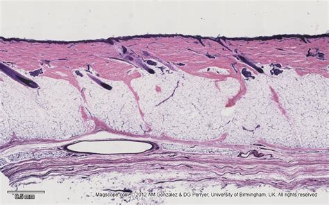 Scalp Histology Labeled