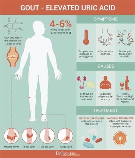 Gout: Symptoms, Causes and Natural Support Strategies | Gout remedies ...