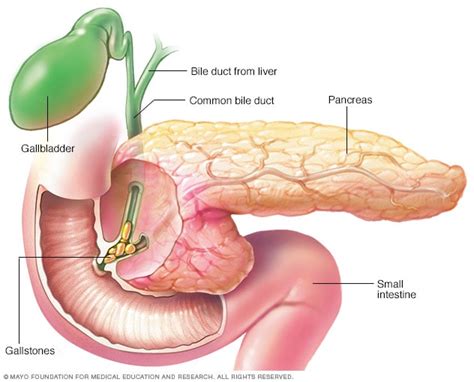 Pancreatitis - Symptoms and causes - Mayo Clinic