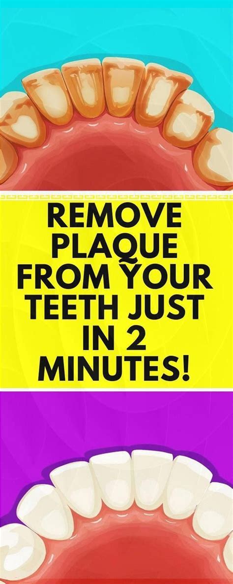 APPLY THIS MIXTURE FOR 60 SECONDS AND REMOVE TARTAR AND PLAQUE FROM ...