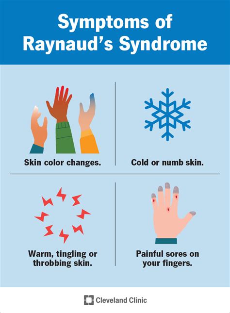 Raynaud’s Syndrome: Symptoms, Causes & Treatment