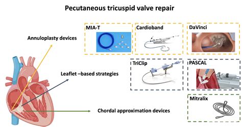 Percutaneous Tricuspid Valve Repair