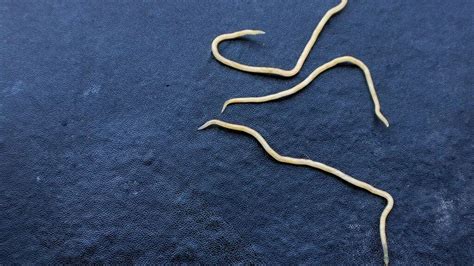 Understanding Pinworms (Threadworms): Causes, Symptoms, and Prevention Tips