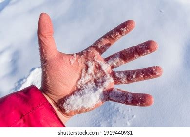 11,185 Frozen Fingers Images, Stock Photos & Vectors | Shutterstock