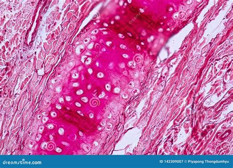 Elastic Cartilage Histology