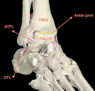 Ankle Ligament Repair Surgery | Private Surgeon London | London Foot ...