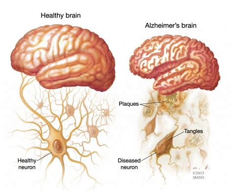 Pin on Health Conditions and Tips