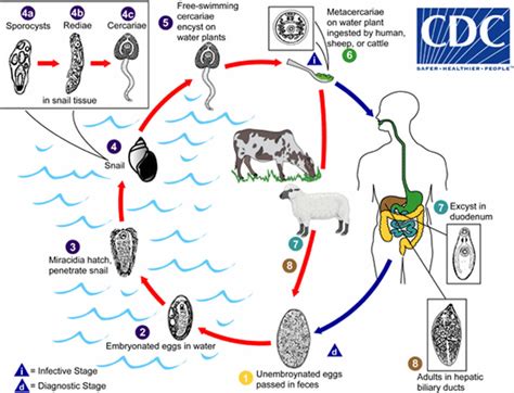 Human liver fluke infection, liver fluke life cycle, symptoms & treatment