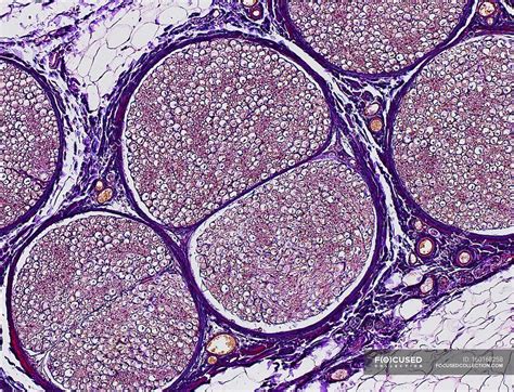 Sciatic nerve showing a bundle of nerve fibres — anatomy, yelinated ...