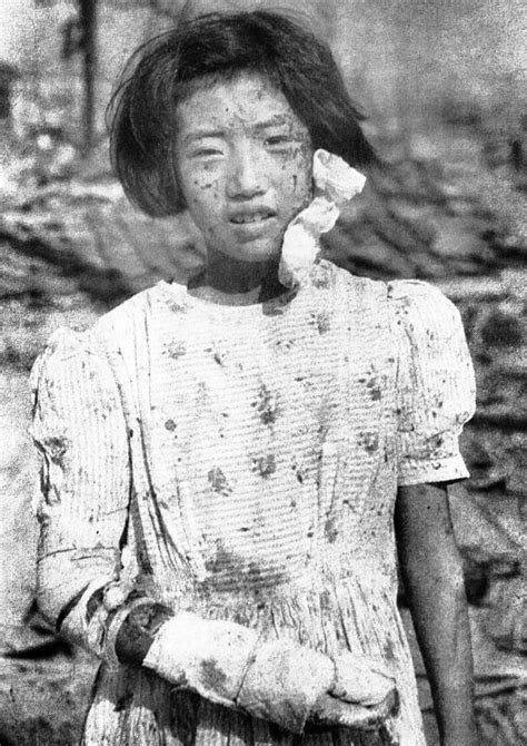 A-bombed girl in 1945 Mainichi photo identified - The Mainichi