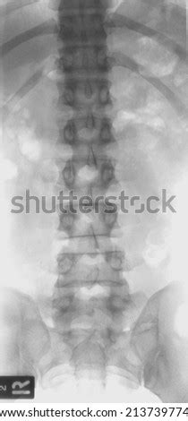 Tailbone Stock Images, Royalty-Free Images & Vectors | Shutterstock