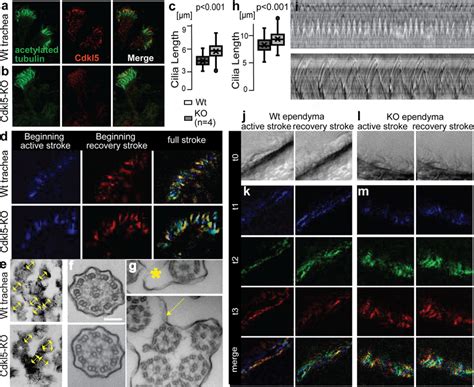 Cdkl5 regulates motile cilia length and beating. a Immunostaining of ...