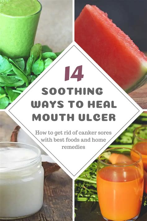 14 Soothing Home Remedies & Best Foods to Heal Mouth Ulcer