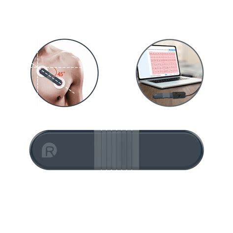 A Comparison of Holter Monitor and Wellue 24-Hour ECG Recorder with AI