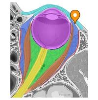 Orbital septum - e-Anatomy - IMAIOS