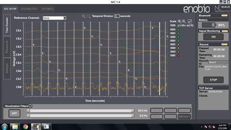 File:Pulses.png - Neuroelectric's Wiki