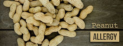 Peanut Allergy: Causes, Symptoms and Treatment