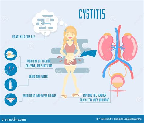 Cystitis Symptoms And Reasons, Treatment Poster Text Vector ...