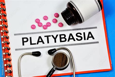 Platybasia is a malformation of the spine. Text inscription on the form in the medical folder ...