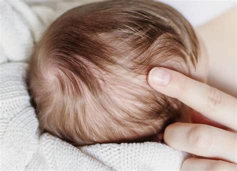 When to be concerned about the soft spot on your baby's head