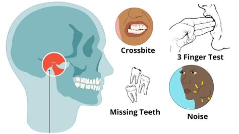 Is Your Jaw UNBALANCED - Uneven Jaw: Causes, Treatments (MUST KNOW) - YouTube