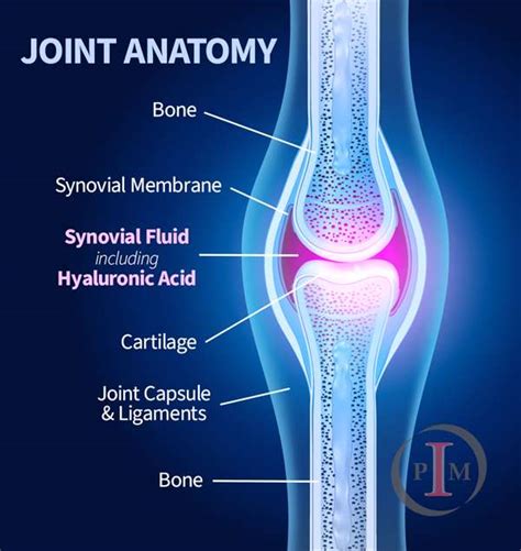 Hyaluronic Acid Injections - Joint Pain Treatment