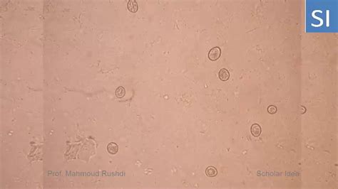 Unsporulated oocyst of coccidia - YouTube