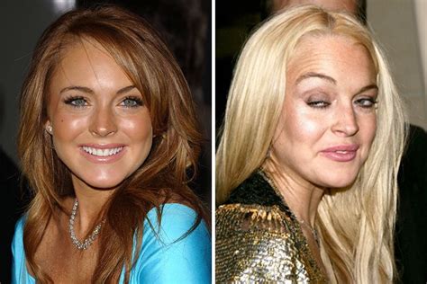 Horrible: 18 Shocking Photos Of Famous Celebrities Before And After Drugs Addiction - GhPage