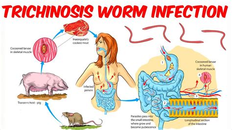 Do Wild Hogs Have Worms? The 15 Detailed Answer - Musicbykatie.com