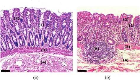 Conventional histology of a normal colon tissue. (a) and (b) HE stained... | Download Scientific ...