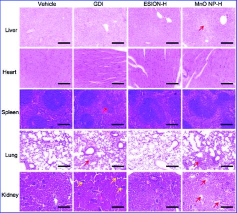 Histopathological images of mouse tissue after 24-h intravenous ...