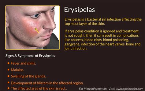 erysipelas caused by strep pyogenes | Skin, Skin diseases, Skin conditions