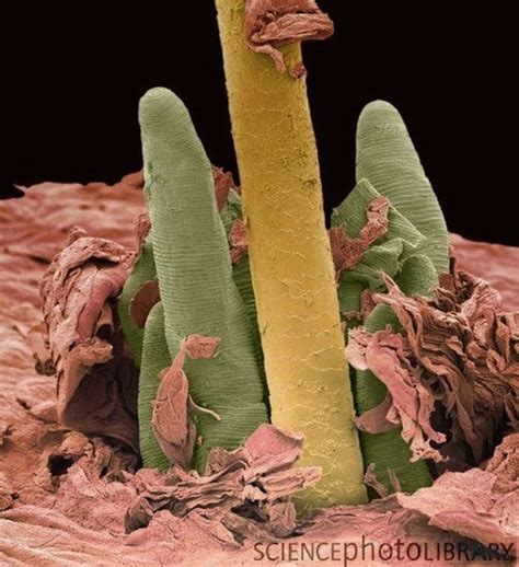 24 best images about Demodex Mites and treatments on Pinterest | Cartoon, Ruins and Eyelashes