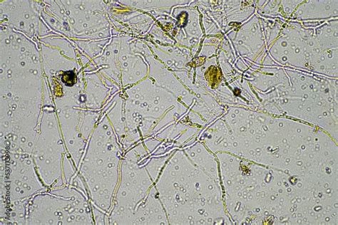 soil fungi under the microscope, soil microbes organisms in a soil and compost sample, fungus ...