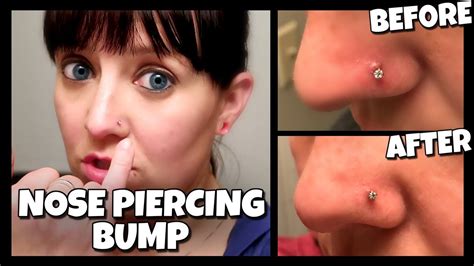 How To Get Rid Of A Nose Piercing Bump FAST! | (Keloid) 📍 How To With Kristin - YouTube