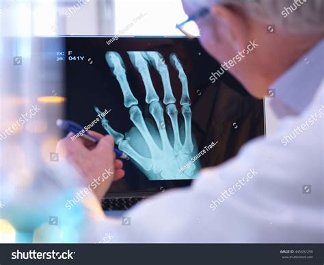 Radiographer Looking Xray Hand Fracture Stock Photo 445692298 ...